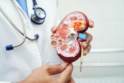 Роль ферроптоза в гибели тубулярных клеток при ишемических болезнях почек